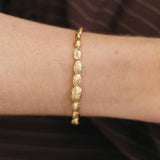 A close-up of a person's wrist wearing a delicate gold chain bracelet with textured, organic-shaped links, set against a dark brown striped background.
